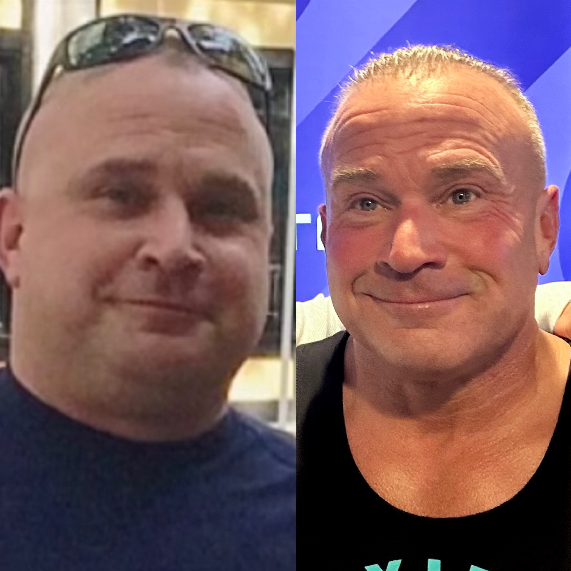 Face changes after weight loss